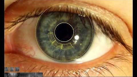 Real-time FPGA-based human iris recognition