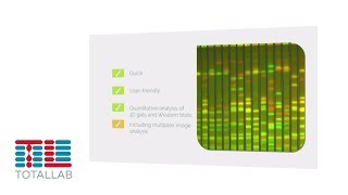 CLIQS | 1D Gel Image Analysis Software | TotalLab