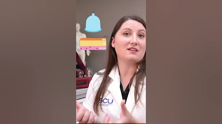 How Does Cupping Work? - DayDayNews