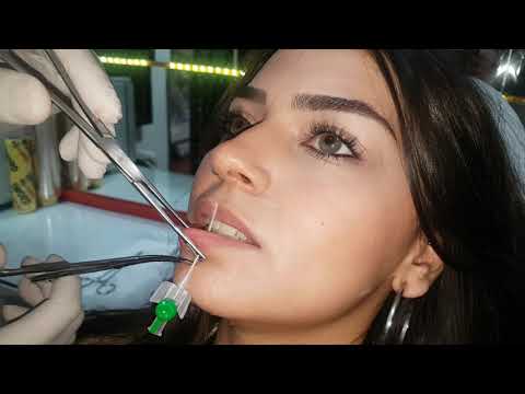 Video: Labret Piercing Nasıl Yapılır (Resimlerle)