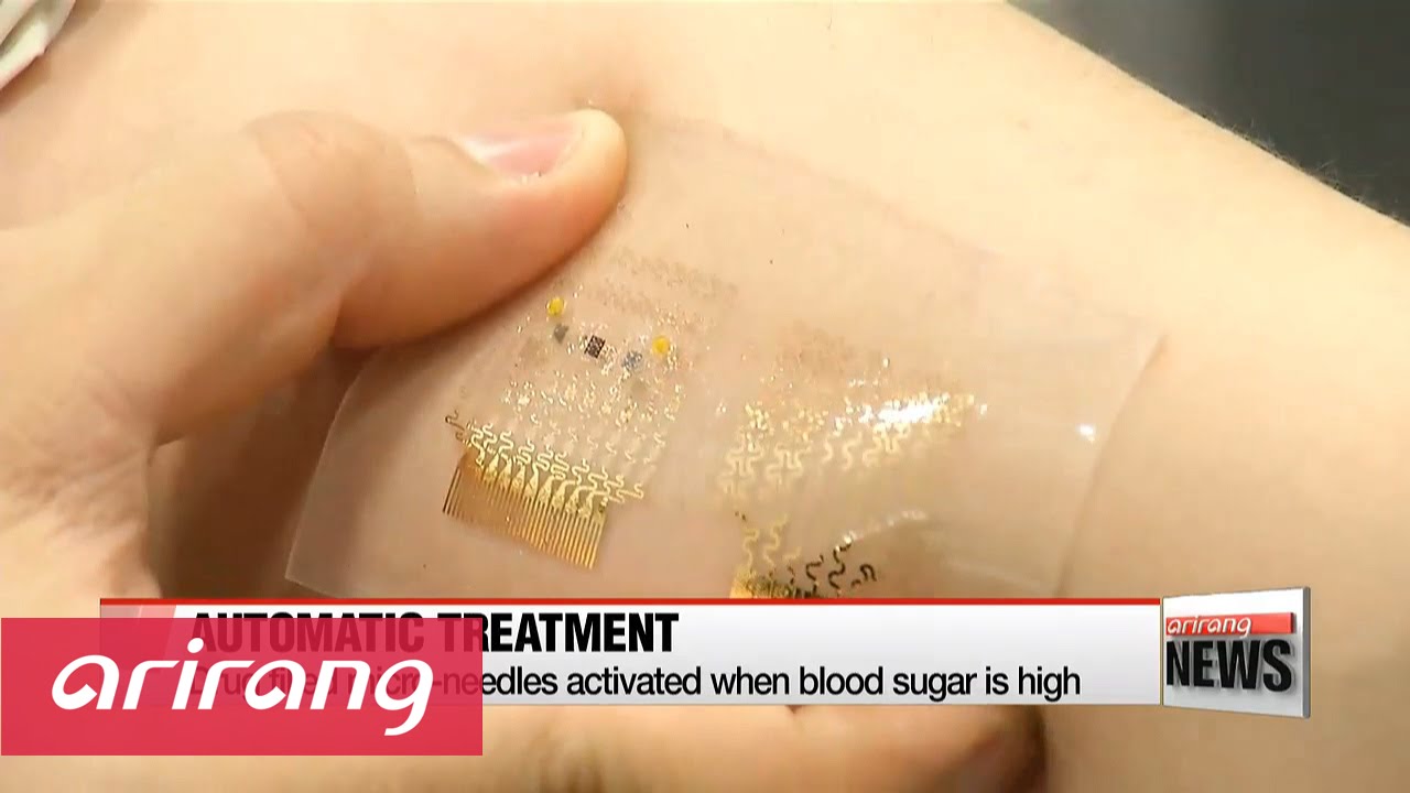 Korean researchers develop nanopatch to monitor diabetes