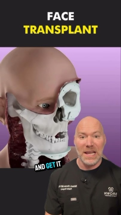 how-face-transplant-surgery-works-youtube