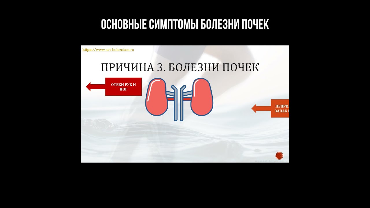 сосудистое заболевание почек