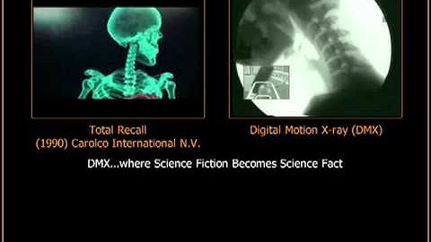 Total Recall