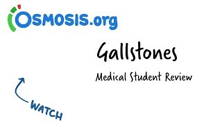 Gallstones | Clinical Presentation