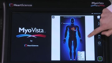 MyoVista Wavelet ECG Device In-Service Video
