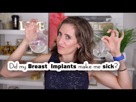 Did My Breast Implants cause my Autoimmune Disease? | BREAST IMPLANT ILLNESS