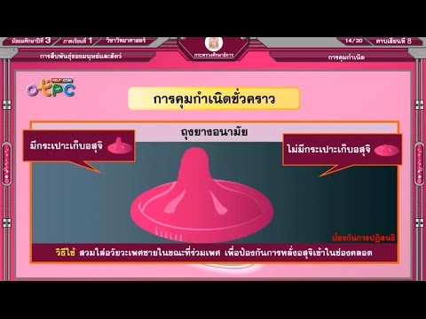 การคุมกำเนิด - สื่อการเรียนการสอน วิทยาศาสตร์ ม.3