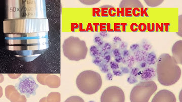 RECHECK PLATELET COUNT