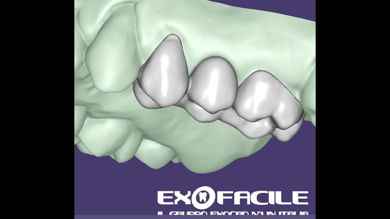 Provv. prelimatura e relativo modello