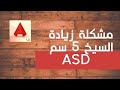 مشكلة زيادة طول السيخ 5سم شوب دروينج اوتوكاد استركشر ديتالنيج ASD Autocad Structural Detailing 