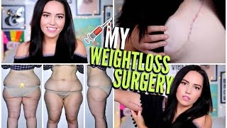 My Weight Loss Surgery