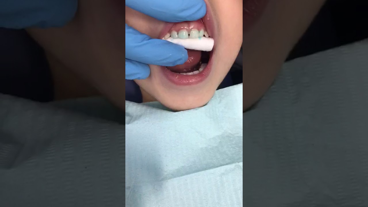 Strip crown tutorial part 2 conditioning for GI YouTube