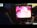 Gastric Sleeve Surgery in Beverly Hills by Dr Feiz