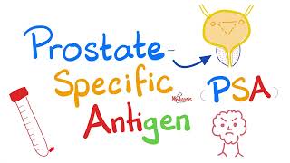 Prostate Specific Antigen (PSA) Test - Prostate Cancer, Large Prostate - Lab results