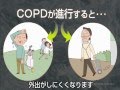 タバコを吸う人は注意！　肺の生活習慣病COPD