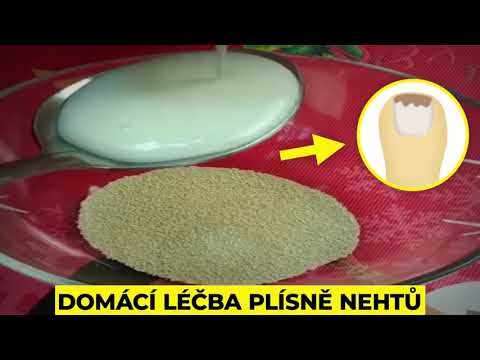 Video: Odtieň Nechtu