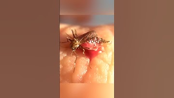 Thumbnail of Los MOSQUITOS EXPLOTAN!.. 🧨🤯 #shorts #curiosidades  #explosion #mosquito #mosquitos #explota #viral