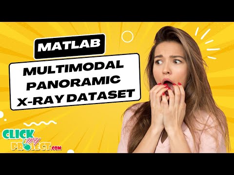 Matlab Image Processing Project - Benchmarking Diagnostic Systems for X-Ray Dataset- ClickMyProject