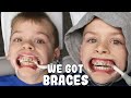 Identical Twins Get Braces - Zac and Chris Family Fun Pack