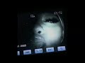 [FREE] Homixide mali x Ken CarsonType Beat - "Resonante"