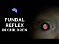 Fundal Reflex (a.k.a. Red Reflex) Assessment in Children - OSCE Guide