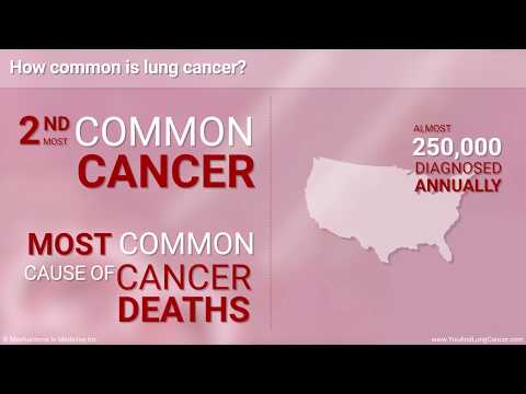 Understanding Small Cell Lung Cancer