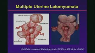 a tüdő endometrium rákja