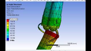 Finite Element Simulation of human Knee Joint Osteoarthritis & ACL Ligament Rupture in Sports Biomed