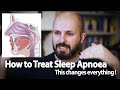 How to treat sleep apnoea  this changes everything