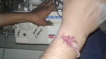 Sirubha err 7   how to reset program  and auto running program