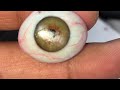 Artificial eye  3d artificial  best eye