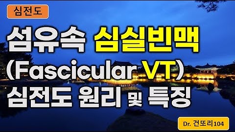 섬유속 심실빈맥(fascicular VT, fascicular ventricular tachycardia) 심전도(ecg) 이해