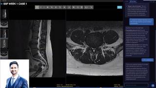 MRI Lumbar Spine | Live Webinar : Systematic Approaches and Case-Based Learning