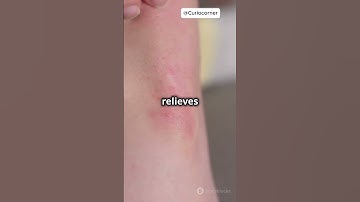 Where does this itch feeling come from?! DID YOU KNOW?!