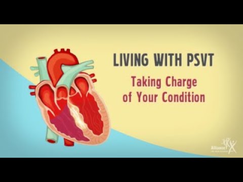 Living with Paroxysmal Supraventricular Tachycardia (PSVT): Taking Charge of Your Condition
