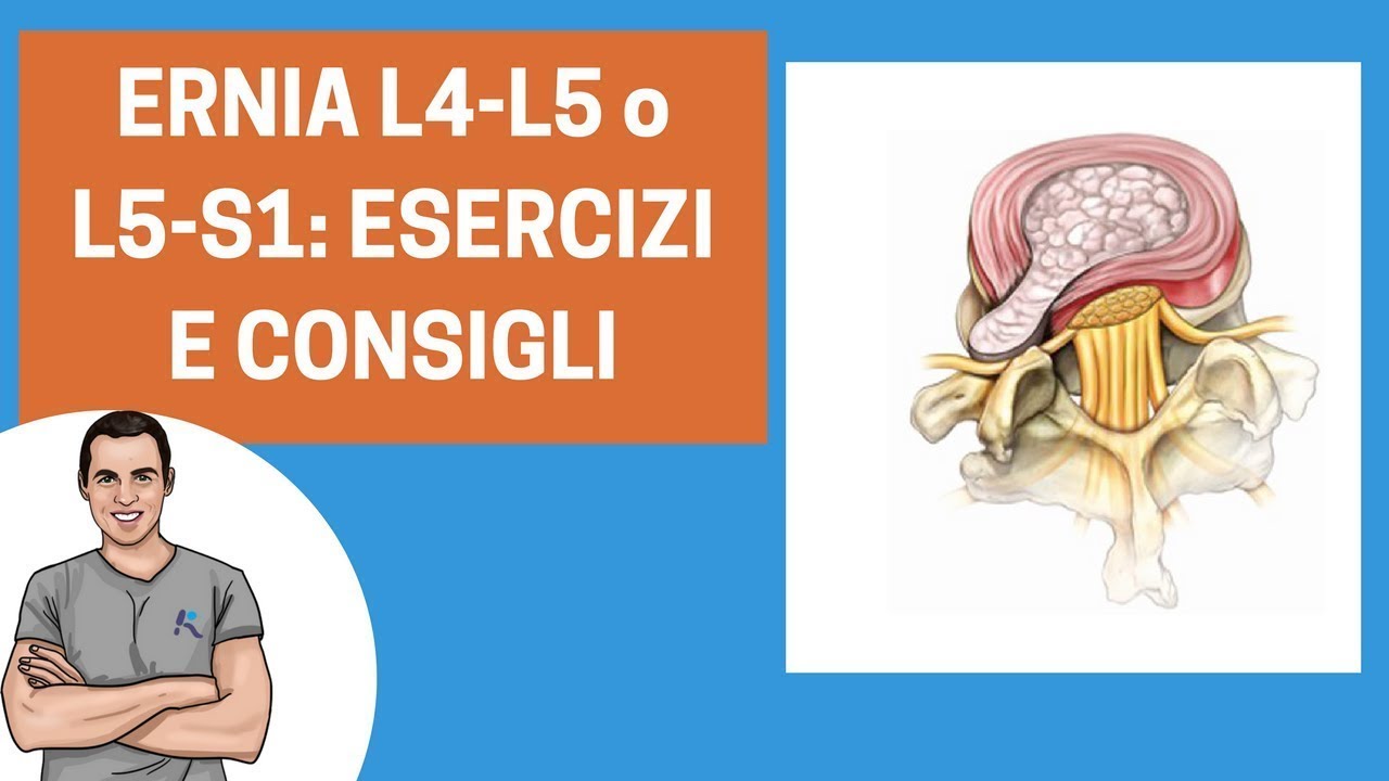 Ernia L4 L5 O L5 S1 Ecco Come Curarsi Consigli Ed Esercizi Youtube