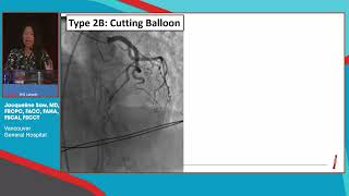 Jacqueline Saw, MD - Case-based presentation: SCAD