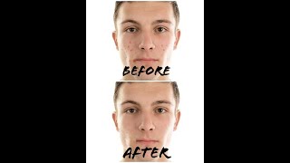 How to remove pimples on adobe photoshop express |adobe photoshop express tutorial. (QAISAR STUDIO) screenshot 2