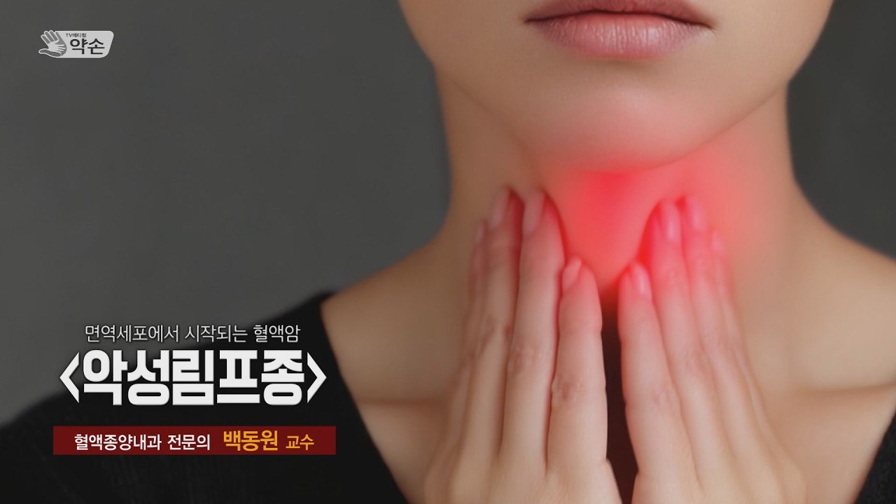 [TV메디컬 약손] 악성림프종