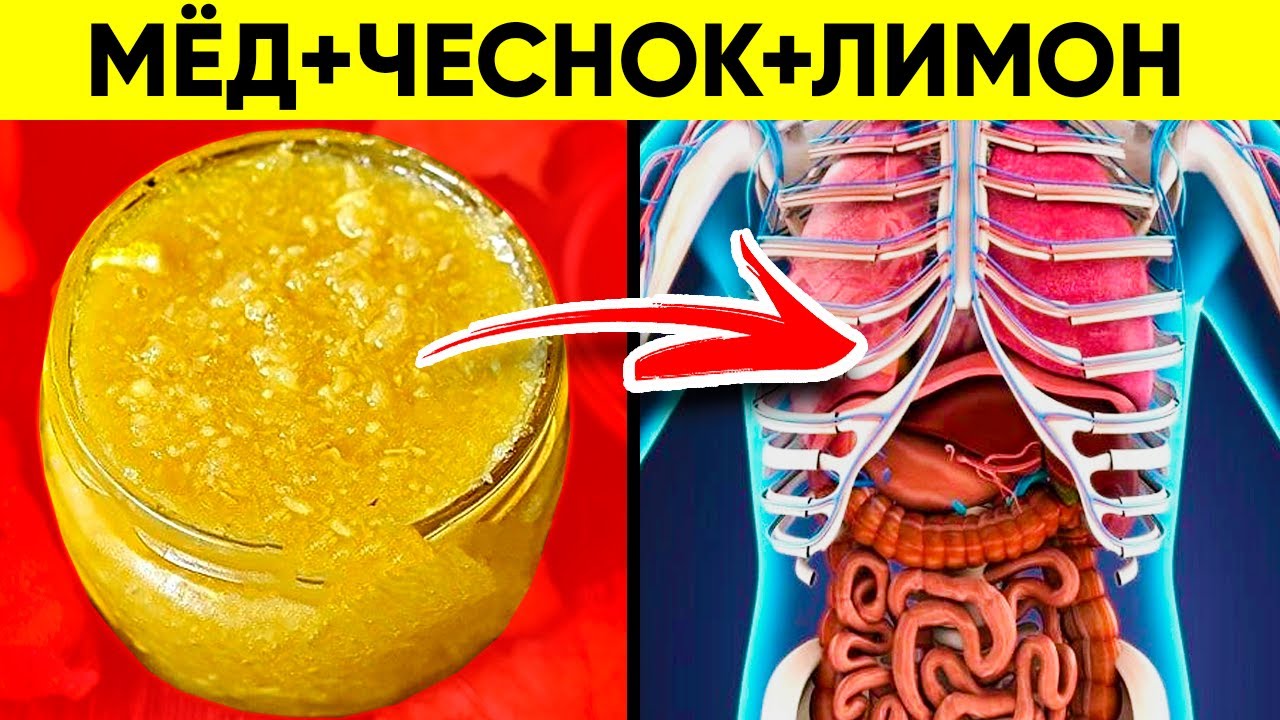 Вот Что Творит Чеснок с Медом и Лимоном! Реальная Польза и Вред Смеси Меда, Чеснока и Лимона