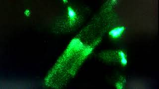 Solitons, calcium waves in isolated rat cardiomyocyte