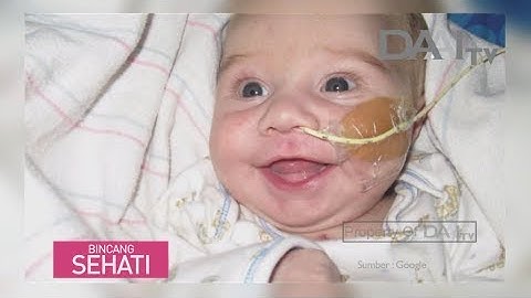 Bincang Sehati "Mengenal Kelainan Jantung Bawaan" | DAAI TV (24/9/18)