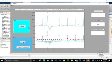 Heart Disease Detection( Arrhythmia) using Artificial Neural Network in MATLAB. | MATLABSolutions