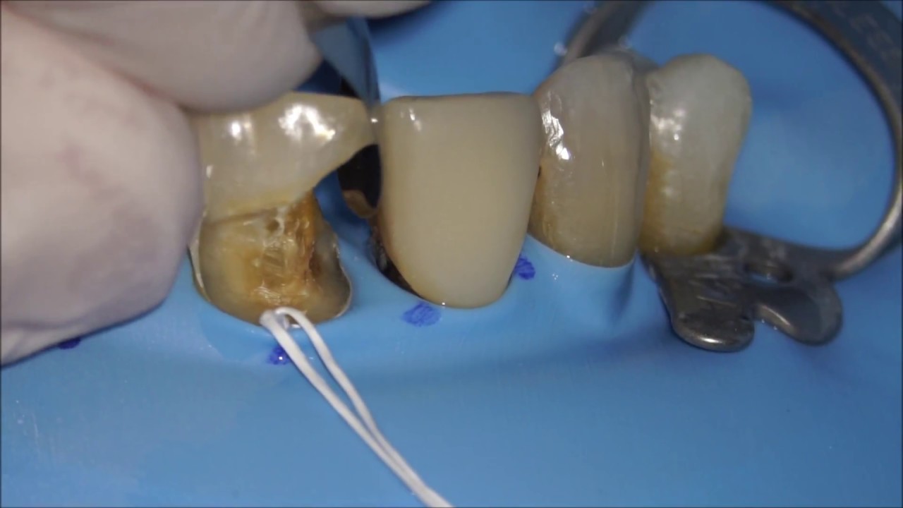 Sectional band YouTube