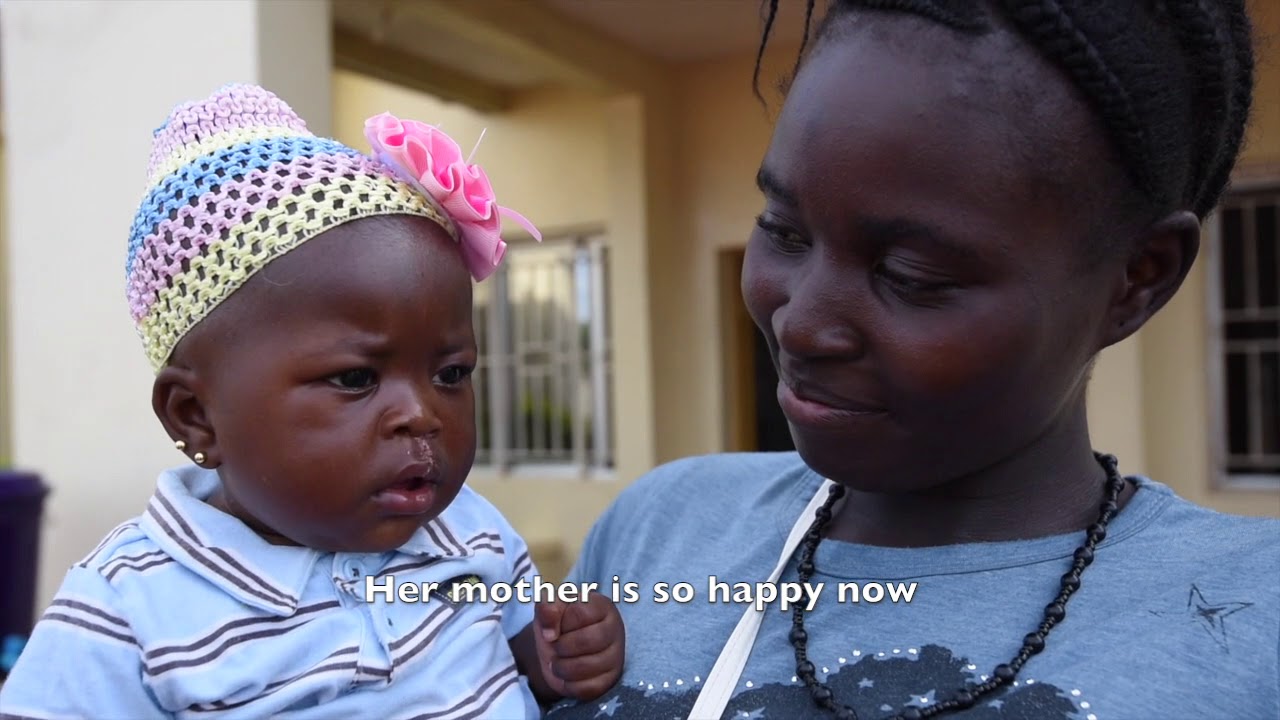 Surg+Restore Cleft Surgery Repair (music by Ojos Feos)