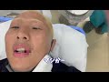 【オーディションの裏側】史上最悪の大怪我をした森許さん