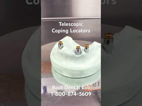 Telescopic Coping Locators