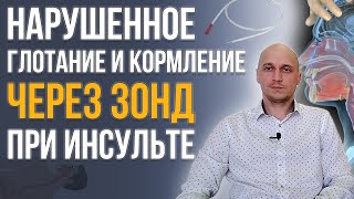 картинка: Нарушение глотания (дисфагия) после инсульта и кормление через назогастральный зонд