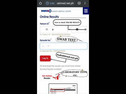 How to check SWAB TEST ONLINE RESULTS Makati Medical Center (Makatimed)